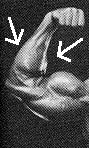The Fore Arm
