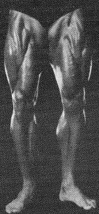 The Legs