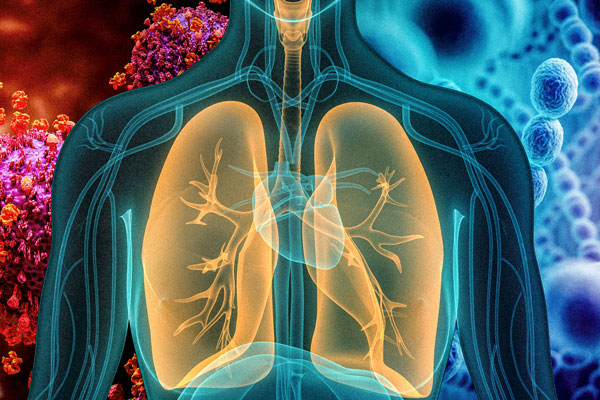 Illustration shows lungs with the background hinting at viral and bacterial pneumonia