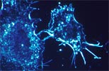 Cancer research
