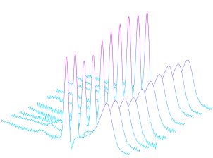 Gari's ECG