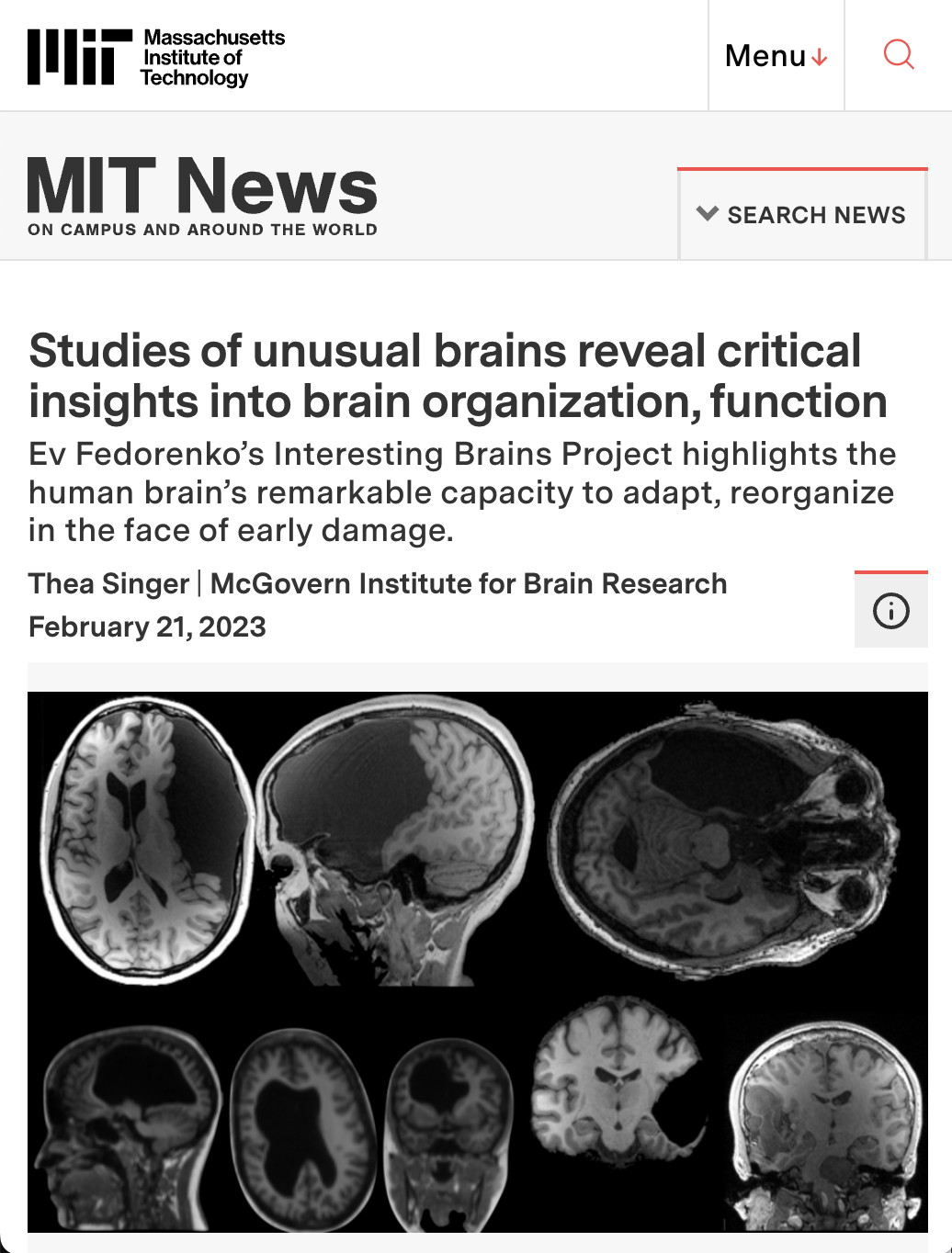 MIT news interesting brain article