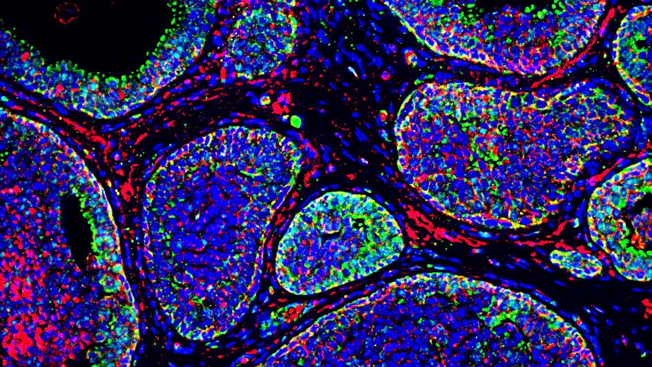 A molecular image of a tumor