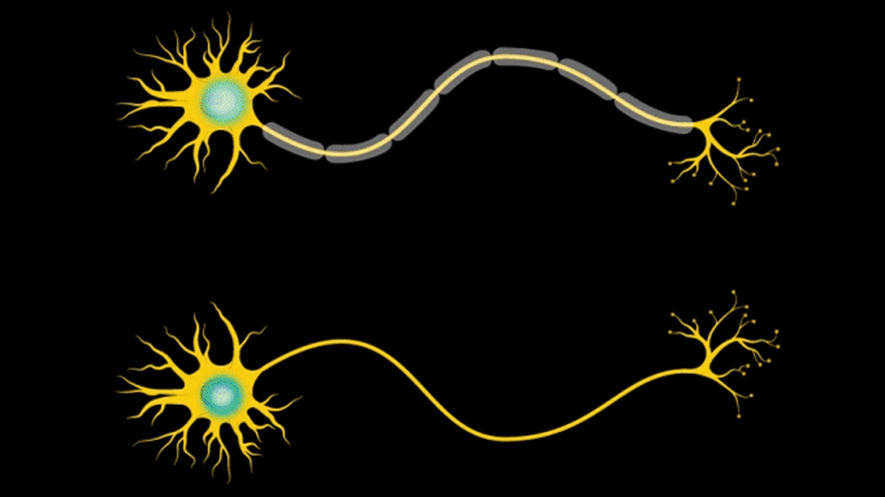 An animation of a neuron with a protective covering called myelin that insulates the axon and increases the speed of electrical communication 