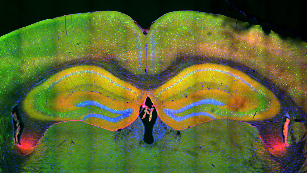 Brain image showing the hippocampus, yellow, near the top
