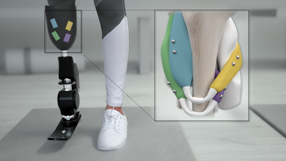 CGI showing model with a prosthetic leg, and interior illustration of the magnetic prosthetic