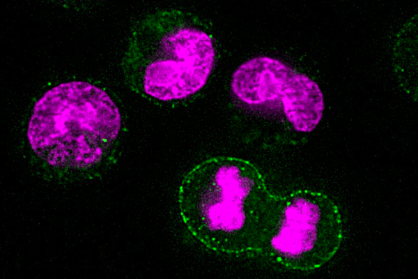 cells covered pink and green against a black background