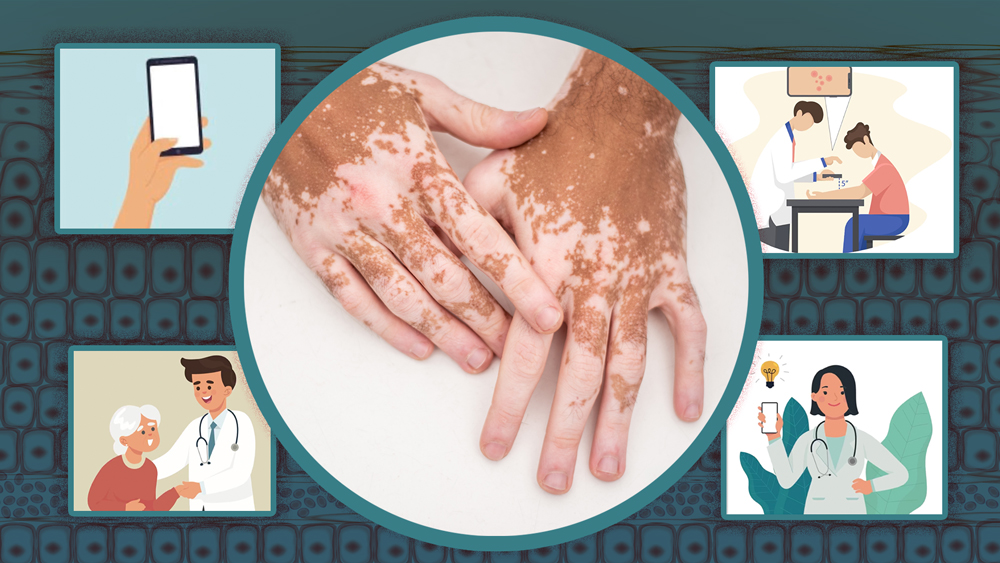 photo of hands with vitiligo and illustrations showing a new medical app