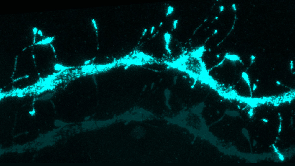 Spotlight: Plentiful silent synapses | MIT - Massachusetts Institute of ...
