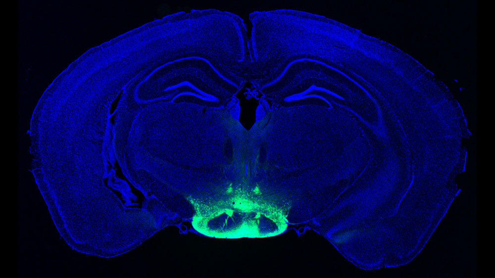 A blue-stained image of a brain where you can see both hemispheres. The bottom center of the brain is stained seafoam green to highlight the mammillary body inside the hypothalamus.