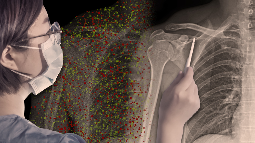 a medical technician looking at an X-ray with the help of an AI assistant