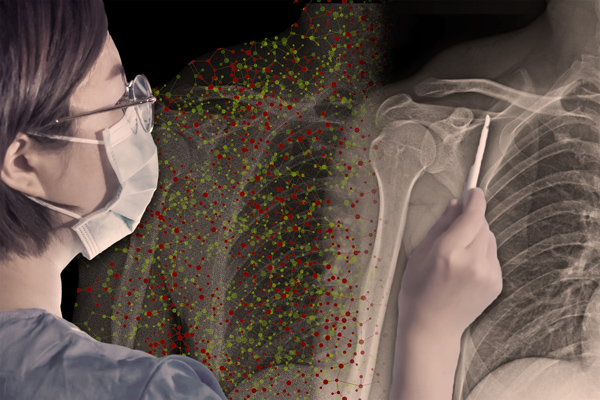 a medical technician looking at an X-ray with the help of an AI assistant