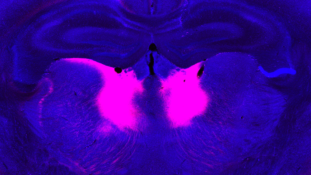 neurons in the mediodorsal thalamus, labeled pink