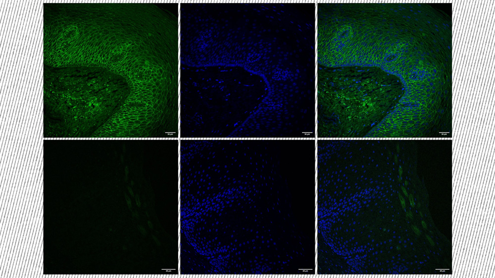 images of treated tissue in green and blue