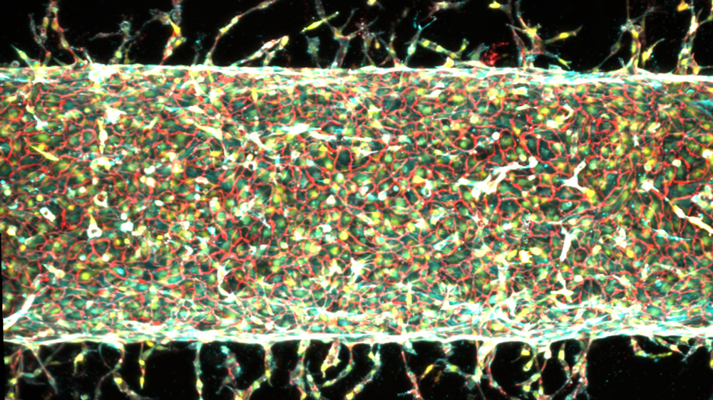 an artificial artery sprouting capillaries