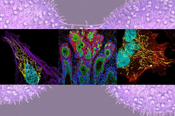 cancer cells