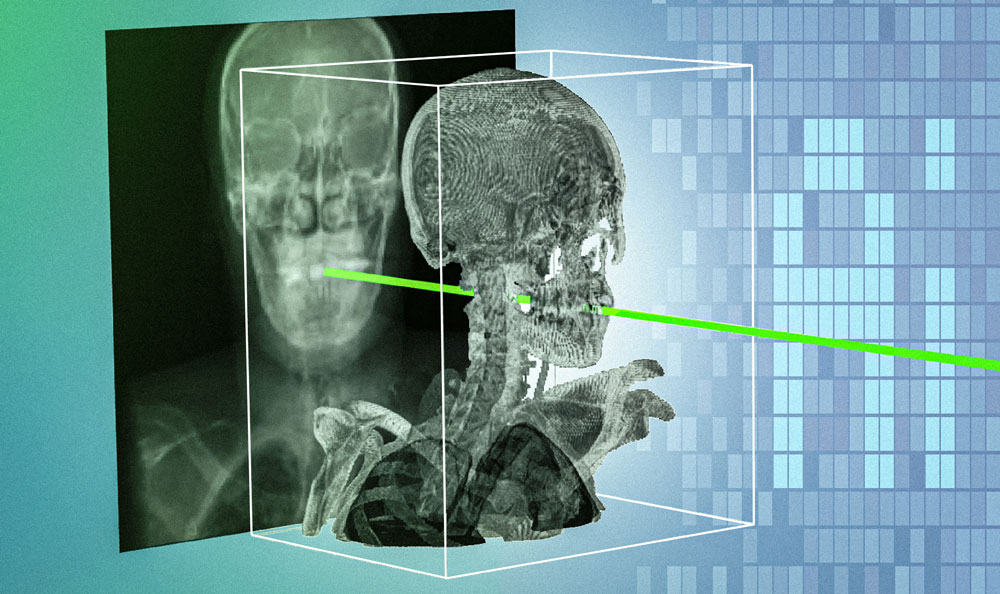 flat 2D skull Xray behind a 3D skull, with "AI" text in background