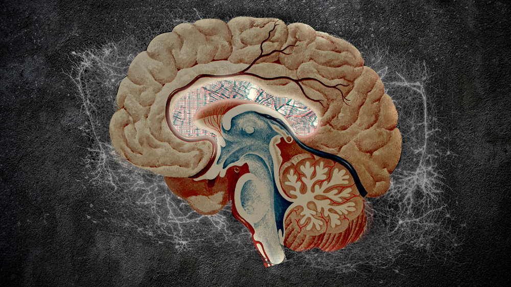 Stylized brain