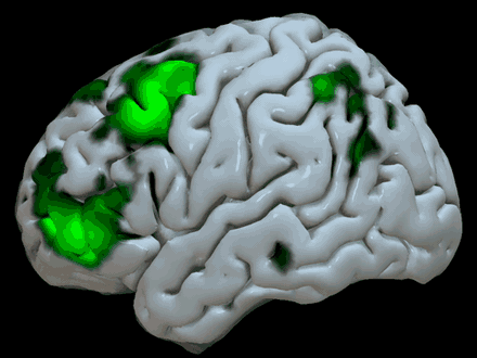 Rotating brain surface showing the logic-selective regions in green