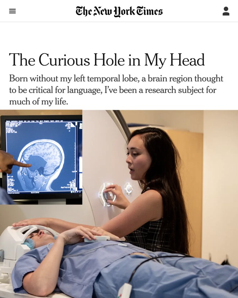The New York Times — The curious hole in my head
