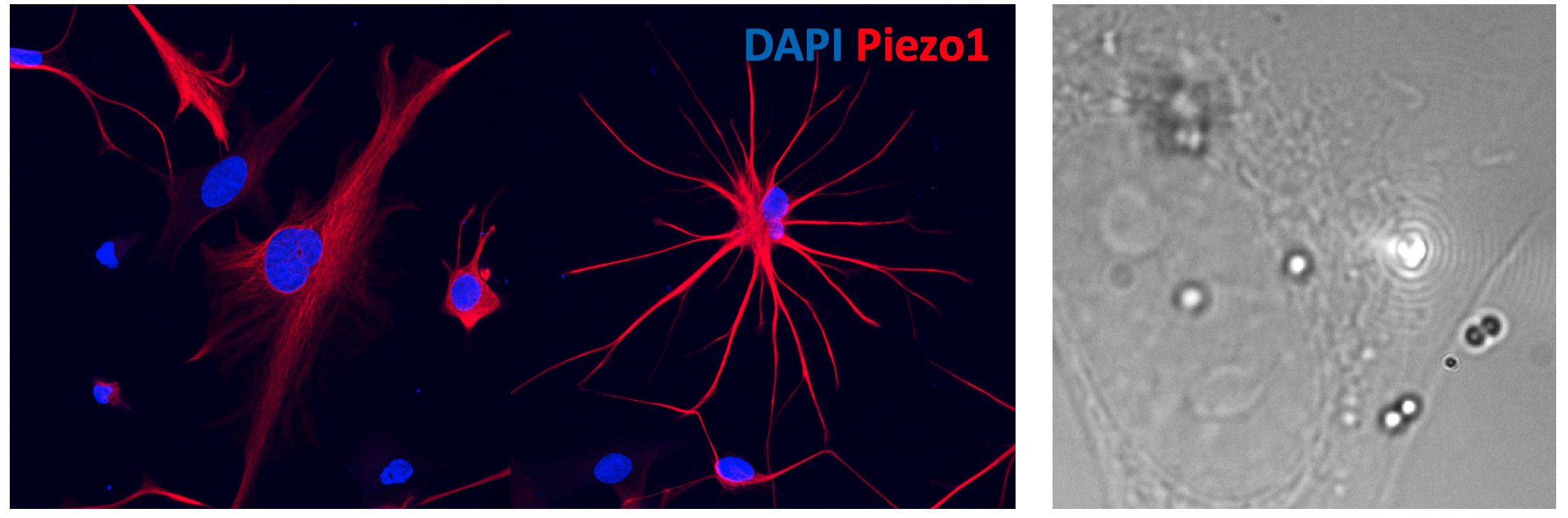 AC-Piezo1